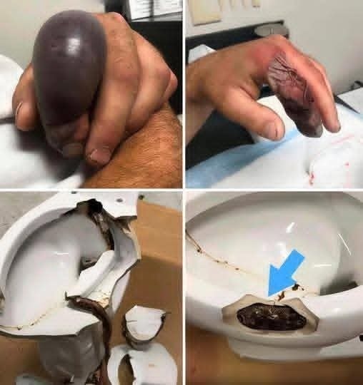 In several regions, while using their toilets, people were attacked by