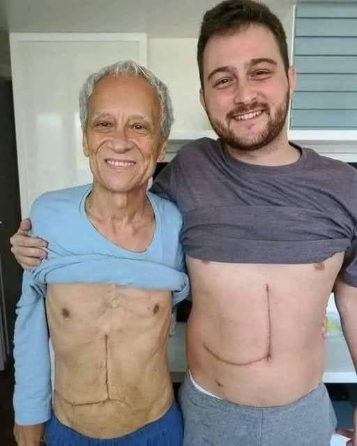 Son who donated part of his liver to his father unfortunately ends up fa…