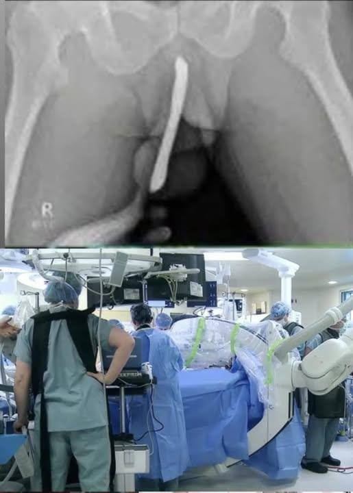 Girl had to be hospitalized for wanting to use a pe