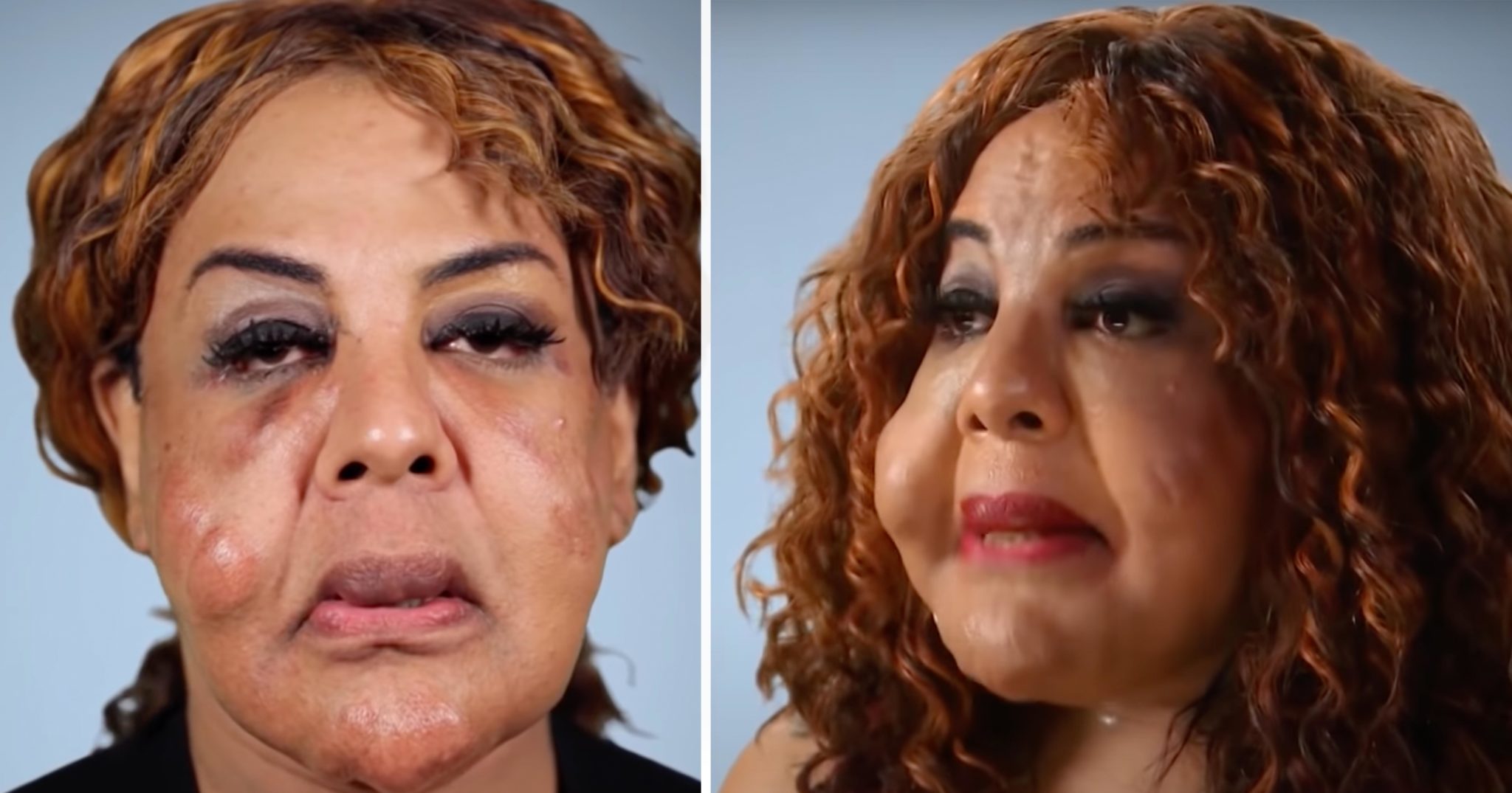What “Cement Face” lady looks like 21 years later