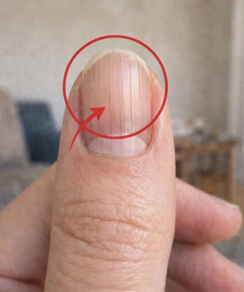 A Doctor Noticed Something Subtle in Fingernails—And It Might Reveal More About Your Health Than You Think