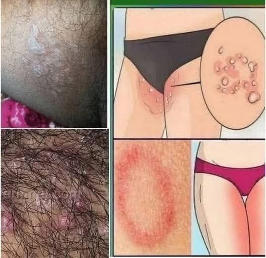 What Your Skin Might Be Trying to Tell You: A Comprehensive Guide to Recognizing Early Body Signals
